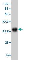 Anti-AURKB Mouse Monoclonal Antibody [clone: 6G8]