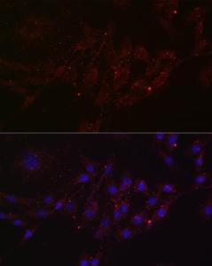 Immunofluorescence analysis of NIH/3T3 cells using Anti-MGRN1 Antibody (A307392) at a dilution of 1:100 (40x lens). DAPI was used to stain the cell nuclei (blue).