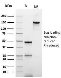 SDS-PAGE analysis of Anti-his tag Antibody [r6HIS/6423] under non-reduced and reduced conditions; showing intact IgG and intact heavy and light chains, respectively. SDS-PAGE analysis confirms the integrity and purity of the antibody