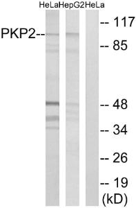 Western blot analysis of lysates from HeLa and HepG2 cells using Anti-PKP2 Antibody. The right hand lane represents a negative control, where the antibody is blocked by the immunising peptide