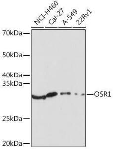 Western blot analysis of extracts of various cell lines, using Anti-OSR1 Antibody (A307394) at 1:1000 dilution. The secondary Antibody was Goat Anti-Rabbit IgG H&L Antibody (HRP) at 1:10000 dilution. Lysates/proteins were present at 25 µg per lane