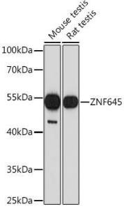 Western blot analysis of extracts of various cell lines, using Anti-CBLL2 Antibody (A308353) at 1:1000 dilution. The secondary Antibody was Goat Anti-Rabbit IgG H&L Antibody (HRP) at 1:10000 dilution. Lysates/proteins were present at 25 µg per lane