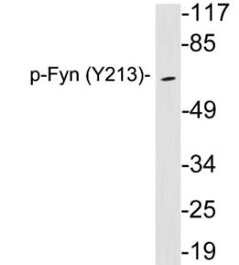 Western blot analysis of lysates from brain tissue using Anti-Fyn (phospho Tyr213) Antibody