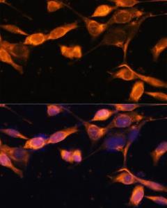 Antibody A305765-100 100 µl