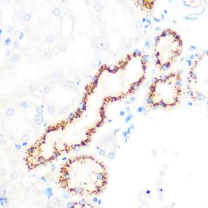 Immunohistochemistry analysis of paraffin-embedded rat kidney using Anti-OSR1 Antibody (A307394) at a dilution of 1:100 (40X lens). Perform microwave antigen retrieval with 10 mM PBS buffer pH 7.2 before commencing with IHC staining protocol