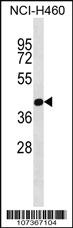 Anti-PRMT6 Rabbit Polyclonal Antibody