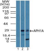 Anti-APH1A Rabbit Polyclonal Antibody