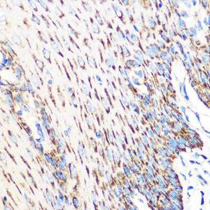 Immunohistochemistry analysis of paraffin-embedded human esophageal using Anti-OSR1 Antibody (A307394) at a dilution of 1:100 (40X lens). Perform microwave antigen retrieval with 10 mM PBS buffer pH 7.2 before commencing with IHC staining protocol