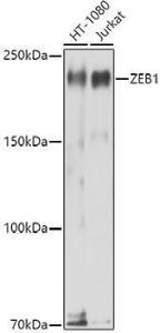 Anti-ZEB1 Rabbit Polyclonal Antibody