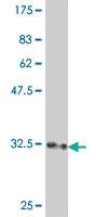 Anti-RPL3L Mouse Polyclonal Antibody