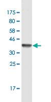 Anti-CSE1L Mouse Monoclonal Antibody [clone: 3F8]