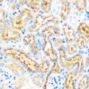 Immunohistochemistry analysis of paraffin-embedded mouse kidney using Anti-OSR1 Antibody (A307394) at a dilution of 1:100 (40X lens). Perform microwave antigen retrieval with 10 mM PBS buffer pH 7.2 before commencing with IHC staining protocol