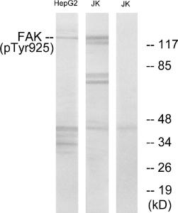 Antibody anti-FAK phospho TYR925 100 µg