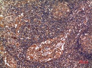 Immunohistochemical analysis of paraffin-embedded human lymph gland using Anti-ALDH2 Antibody