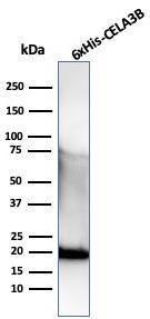 Western blot analysis of recombinant CELA3B protein (his tag) using Anti-his tag Antibody [r6HIS/6423]