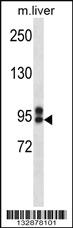 Anti-ABCC12 Rabbit Polyclonal Antibody