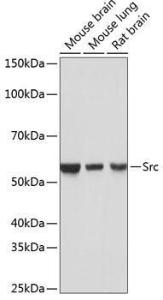 Western blot analysis of extracts of various cell lines, using Anti-Src Antibody [ARC0378] (A307395) at 1:1,000 dilution. The secondary antibody was Goat Anti-Rabbit IgG H&L Antibody (HRP) at 1:10,000 dilution.