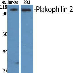 Western blot analysis of various cells using Anti-PKP2 Antibody