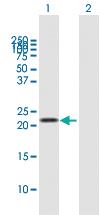 Anti-LCN2 Mouse Polyclonal Antibody