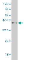 Anti-PCDH1 Mouse Monoclonal Antibody [clone: 4H2]