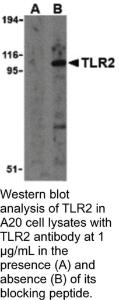 Anti-TLR2 Rabbit Polyclonal Antibody