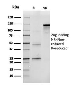 SDS-PAGE analysis of Anti-CD43 Antibody [SPN/3388] under non-reduced and reduced conditions; showing intact IgG and intact heavy and light chains, respectively. SDS-PAGE analysis confirms the integrity and purity of the antibody.