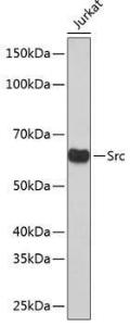 Western blot analysis of extracts of Jurkat cells, using Anti-Src Antibody [ARC0378] (A307395) at 1:1,000 dilution. The secondary antibody was Goat Anti-Rabbit IgG H&L Antibody (HRP) at 1:10,000 dilution.