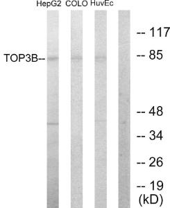 Anti-TOP3B antibody