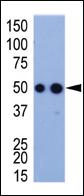 Anti-HA tag Rabbit Polyclonal Antibody