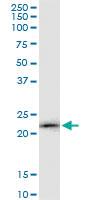 Anti-LCN2 Mouse Polyclonal Antibody