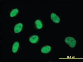 Anti-ZNF143 Mouse Monoclonal Antibody [clone: 3A7]