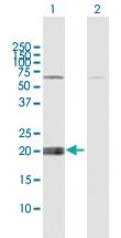 Anti-IFNE Rabbit Polyclonal Antibody