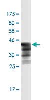 Anti-HSPB7 Mouse Monoclonal Antibody [clone: 1G12]