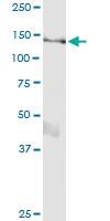 Anti-RALGDS Polyclonal Antibody Pair