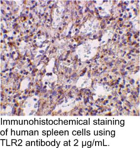 Anti-TLR2 Rabbit Polyclonal Antibody