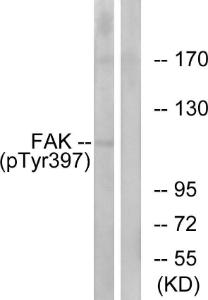 Western blot analysis of lysates from 293 cells treated with EGF 200ng/ml 30' using Anti-FAK (phospho Tyr397) Antibody The right hand lane represents a negative control, where the antibody is blocked by the immunising peptide