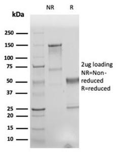 Anti-Human Nuclear Antigen antibody