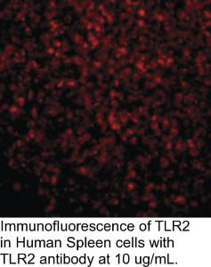 Anti-TLR2 Rabbit Polyclonal Antibody