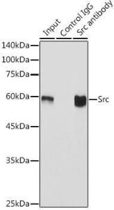 Immunoprecipitation analysis of 600µg extracts of mouse brain using 3µg of Anti-Src Antibody [ARC0378] (A307395). This Western blot was performed on the immunoprecipitate using Anti-Src Antibody [ARC0378] (A307395) at a dilution of 1:1000.