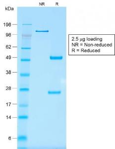 SDS-PAGE analysis of Anti-EpCAM Antibody [rMOC-31] under non-reduced and reduced conditions; showing intact IgG and intact heavy and light chains, respectively. SDS-PAGE analysis confirms the integrity and purity of the antibody