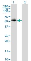 Anti-PPP2R2C Mouse Monoclonal Antibody [clone: 6D1]