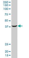 Anti-PCGF2 Mouse Monoclonal Antibody [clone: 4D6]