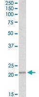 Anti-PSMB9 Goat Polyclonal Antibody