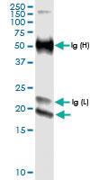 Anti-IFNE Rabbit Polyclonal Antibody