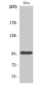 Western blot analysis of HepG2 cells using Anti-PKP2 Antibody