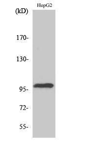 Anti-TOP3B antibody