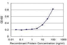 Anti-PCGF2 Mouse Monoclonal Antibody [clone: 4D6]