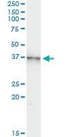 Anti-AURKB Mouse Monoclonal Antibody