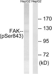 Western blot analysis of lysates from HepG2 cells treated with PMA 125 ng/ml 20' using Anti-FAK (phospho Ser843) Antibody. The right hand lane represents a negative control, where the antibody is blocked by the immunising peptide