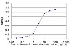 Anti-PPP2R2C Mouse Monoclonal Antibody [clone: 6D1]